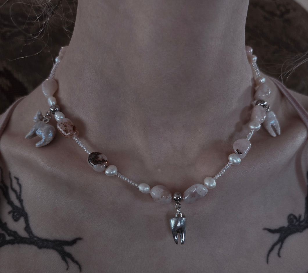 Tooth choker